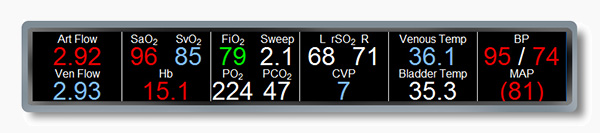 Extra-Corporeal Patient Monitoring