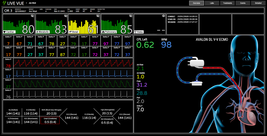 livevue-detail